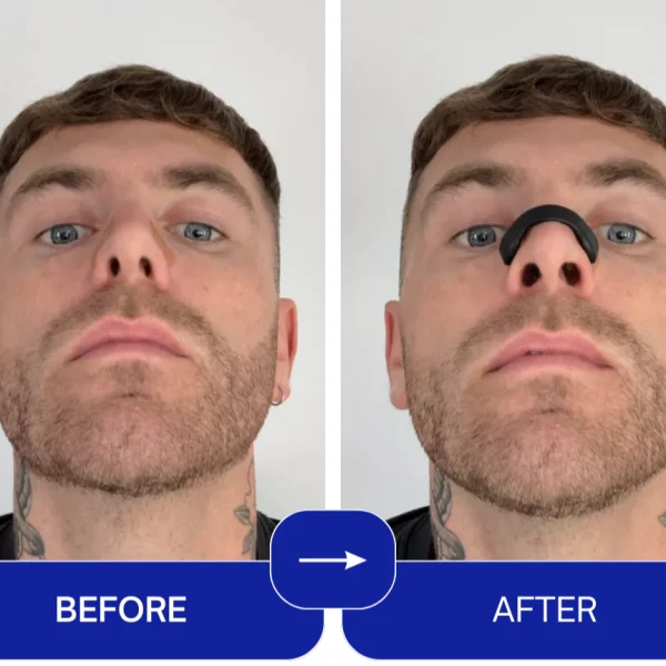 EasyBreathe – Magnetické nosní proužky (balení 15 ks) slider