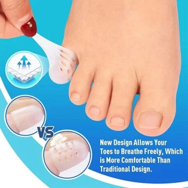 Toe Protector – Chrániče prstů (10 kusů) slider