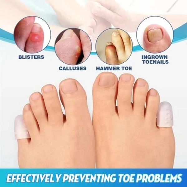 Toe Protector – Chrániče prstů (10 kusů) slider