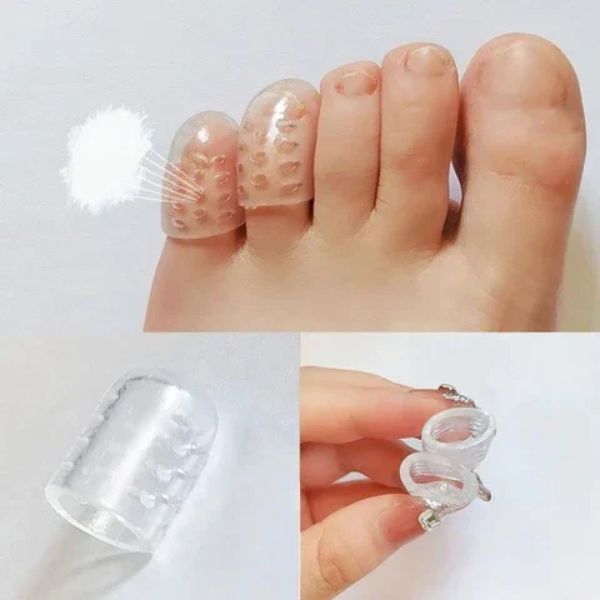Toe Protector – Chrániče prstů (10 kusů) slider